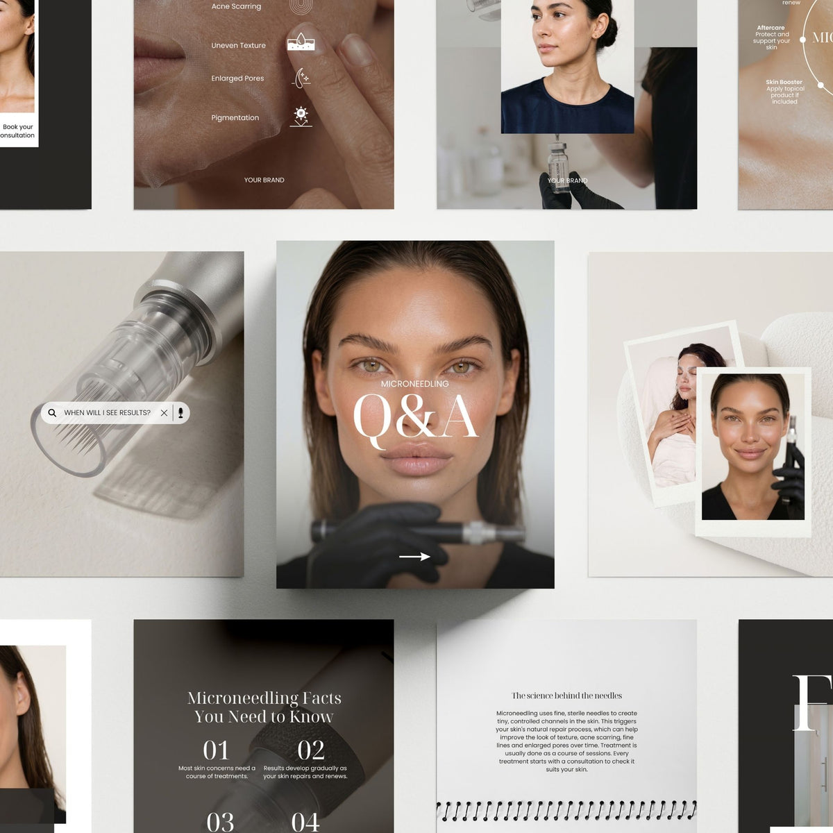 Microneedling Social Media Templates