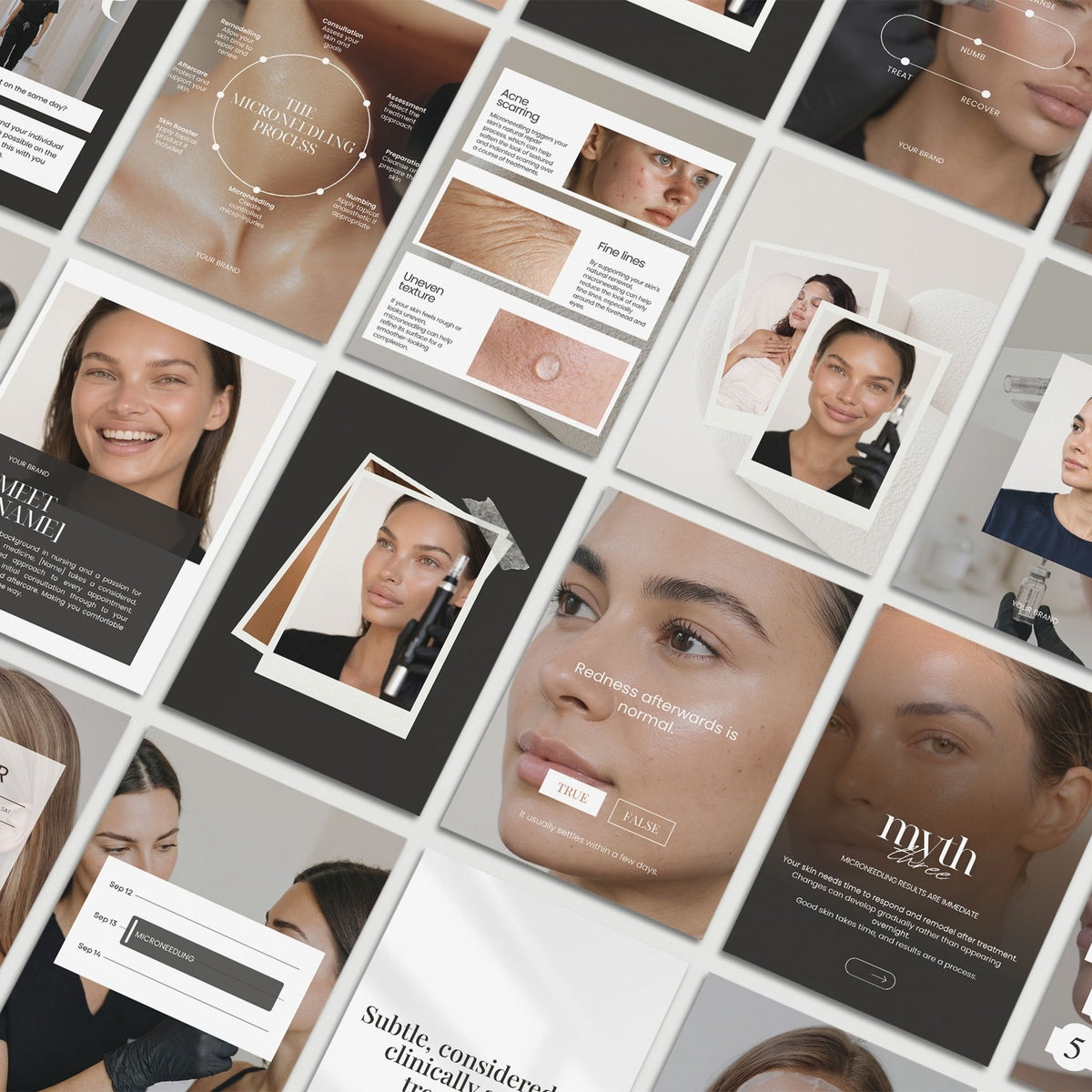Microneedling Social Media Templates